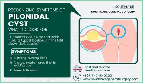 Can girls get pilonidal cyst