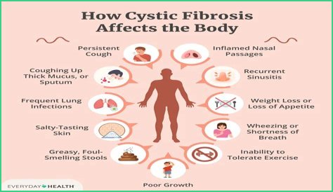 What is Fibrositis pain?